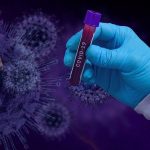 Pozitivnih 44 % izvidov PCR testov. Umrlo 21 obolelih za covidom-19. Avstrija prva v Evropi z lockdownom za necepljene